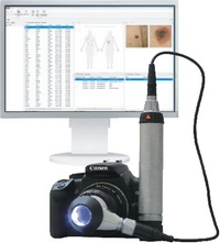 Цифровой дерматоскоп Heine