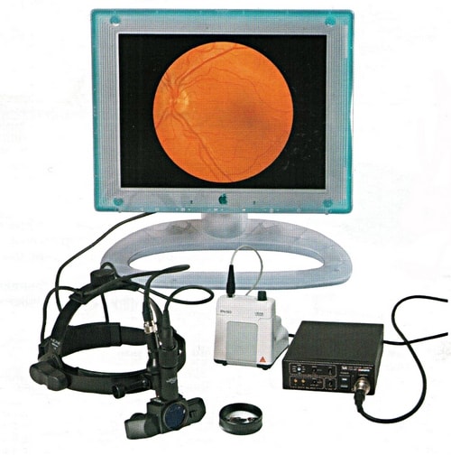 Video OMEGA 2C Видеоофтальмоскоп